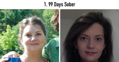 20 Before-And-After Pics Show What Happens When You Stop Drinking