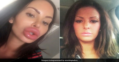 200 सर्जरी और 16 करोड़ खर्च कर ऐसी दिखने लगी ये लड़की, CLICK