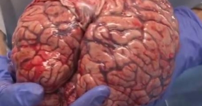 Amazing facts about human brain?